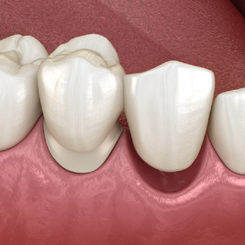 Treatment - Family Dental Care Centre