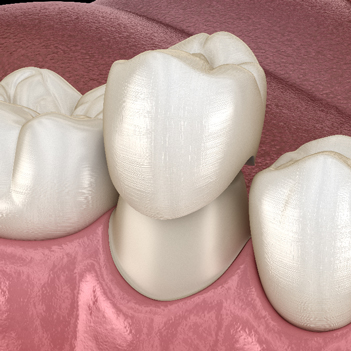 Treatment - Family Dental Care Centre