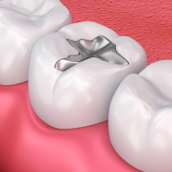 Treatment - Family Dental Care Centre