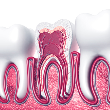 Treatment - Family Dental Care Centre