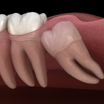 Treatment - Family Dental Care Centre