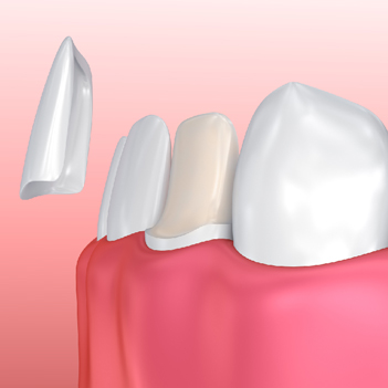 Treatment - Family Dental Care Centre