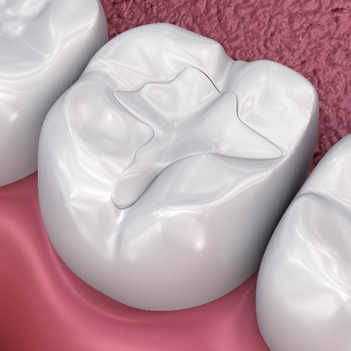 Treatment - Family Dental Care Centre